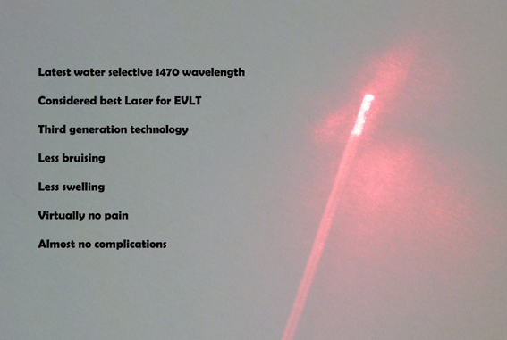 Best-laser-varicose-veins